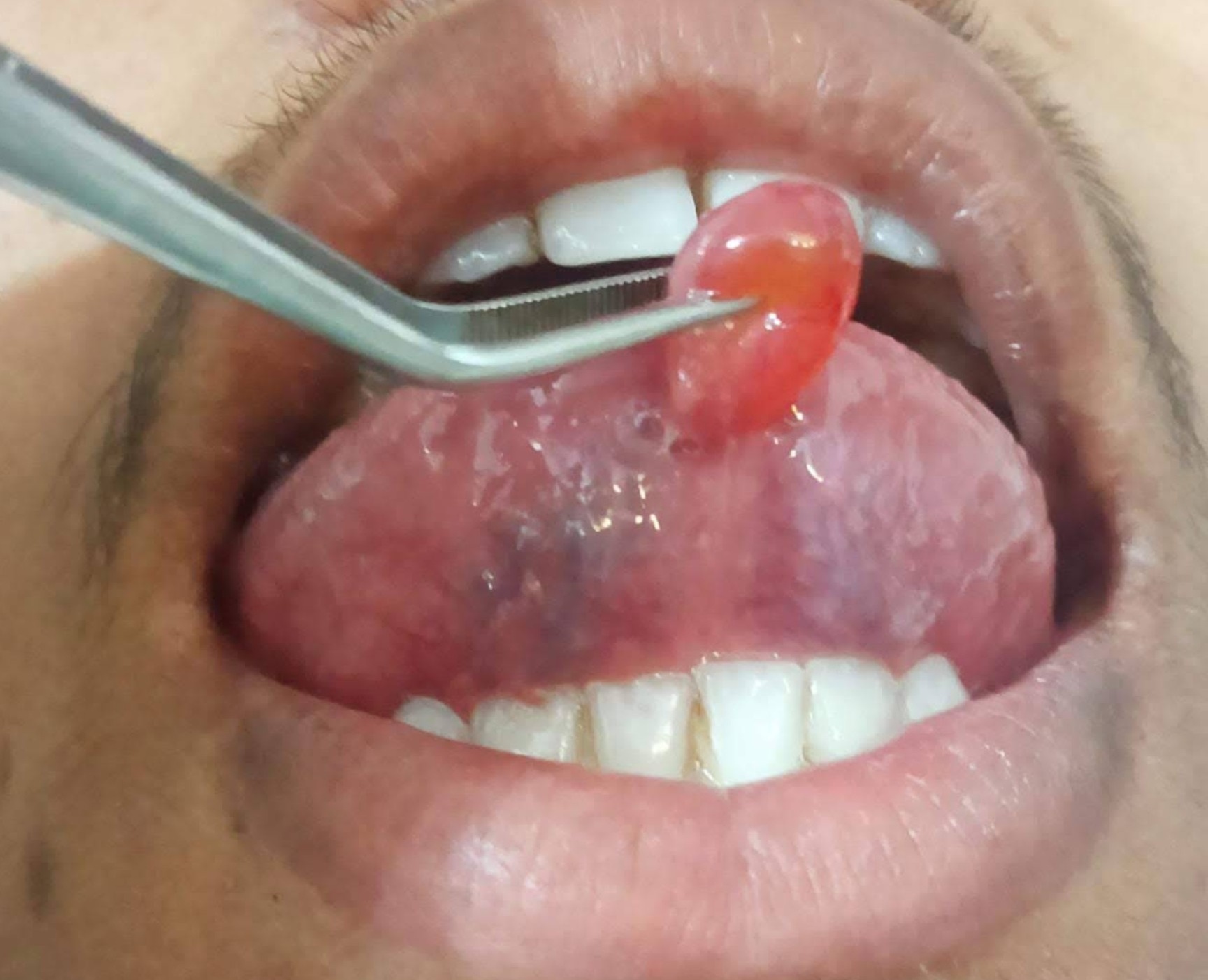 Modern Dental Operatory Room at Hi Dent Dental Clinic Kokar Ranchi